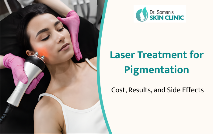 Laser Treatment for Pigmentation: Cost, Results, and Side Effects