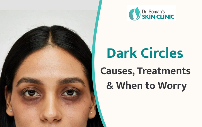 Dark Circles Under Your Eyes: 7 Real Causes, Proven Treatments & When to See a Doctor