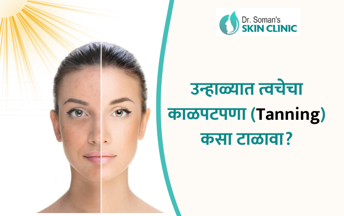 उन्हाळ्यात त्वचेचा काळपटपणा (Tanning) कसा टाळावा