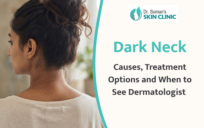 Dark Neck: Causes, Treatment Options and When to See a Dermatologist